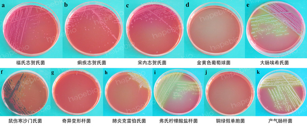 誌賀氏菌顯色培養基微生物質控結果