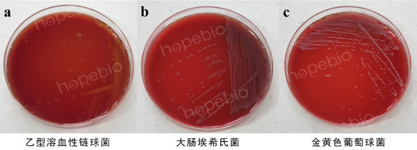 圖1-1 血瓊脂基礎2號微生物質控結果