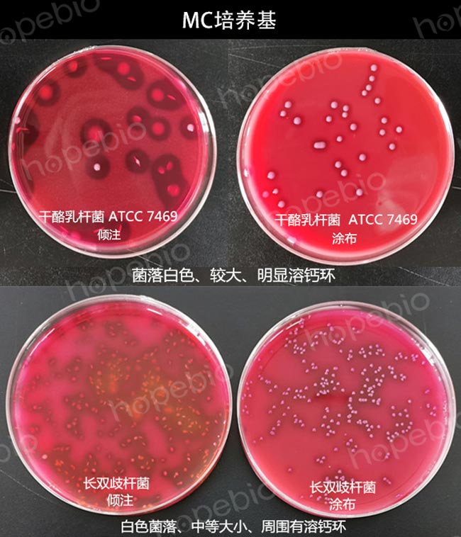 MC瓊脂上的菌落特征