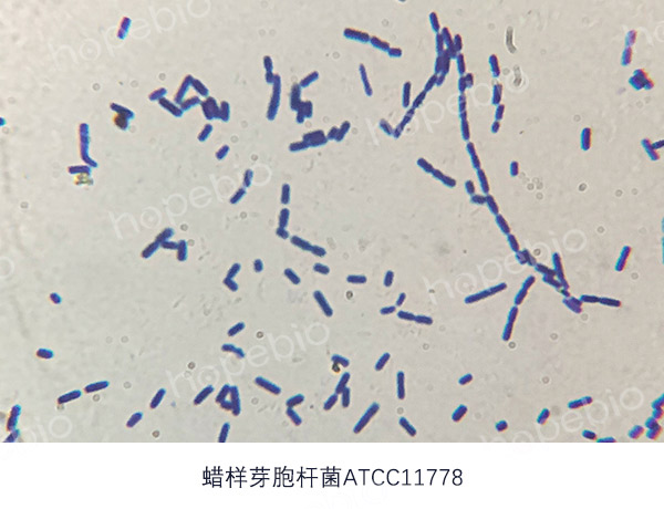 革蘭氏染色鏡檢圖——蠟樣芽孢杆菌