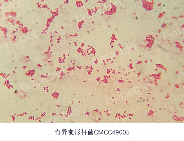 革蘭氏染色鏡檢圖——奇異變形杆菌