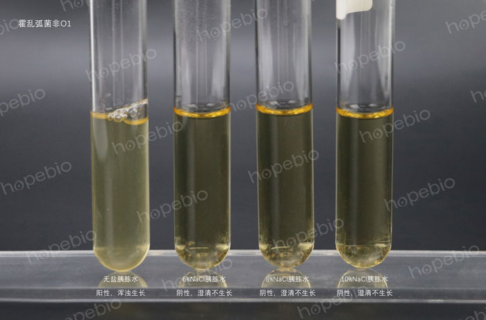 嗜鹽性試驗-霍亂弧菌非O1-betway必威西汉姆联
