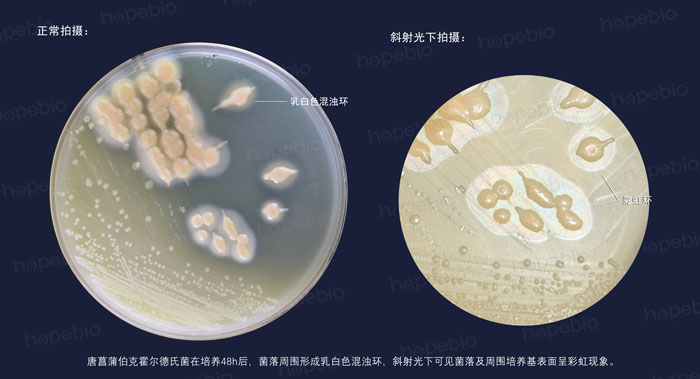 卵黃瓊脂——唐菖蒲伯克霍爾德氏菌