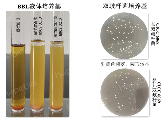 雙歧杆菌在兩種培養基上的生長特征