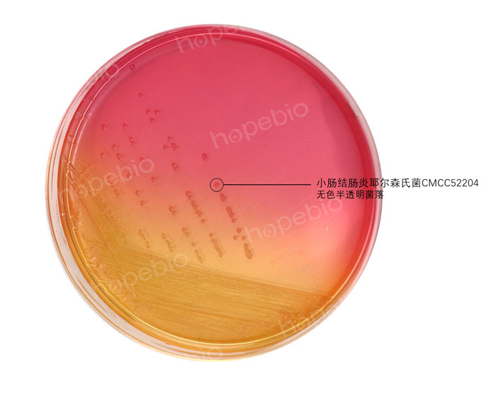 SS瓊脂-小腸結腸炎耶爾森氏菌