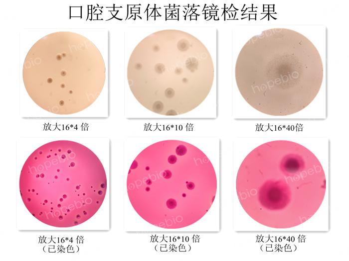 口腔支原體菌落鏡檢結果