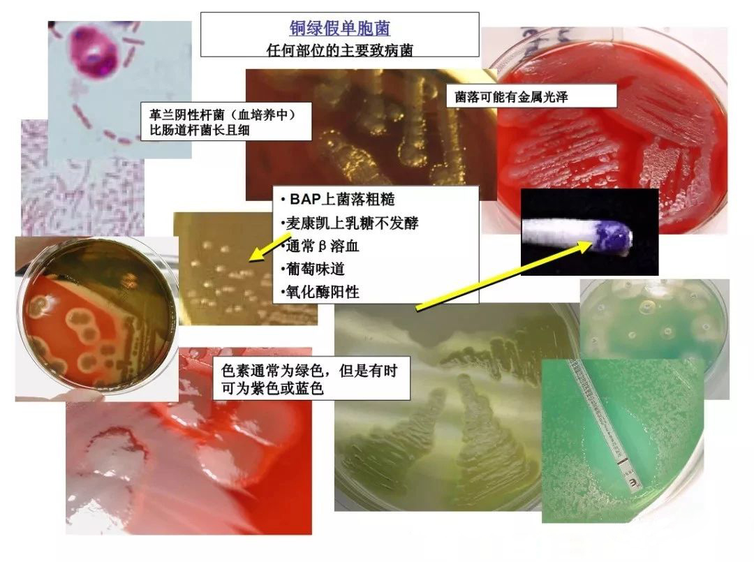 銅綠假單胞菌生化特征/